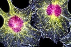 Новые исследования израильских ученых применения стволовых клеток в кардиологии